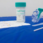 Inicialmente ofertada em 12 estados brasileiros, incluindo o Paraná, a tecnologia 100% nacional detecta 14 genótipos do papilomavírus humano (HPV).